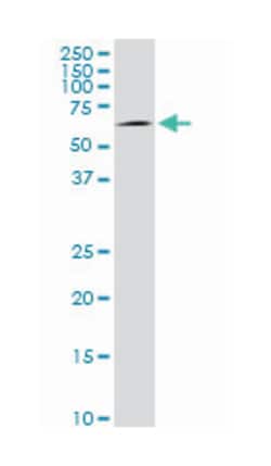 v-akt murine thymoma viral oncogene homolog 1, Mouse, Clone: 2E11, Abnova