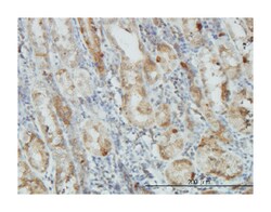 v-akt murine thymoma viral oncogene homolog 1, Mouse, Clone: 2E11, Abnova