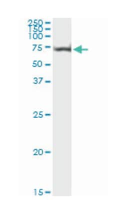 v-akt murine thymoma viral oncogene homolog 1, Mouse, Clone: 2E11, Abnova