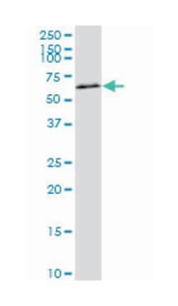 v-akt murine thymoma viral oncogene homolog 2, Mouse, Clone: 1B4, Abnova&trade;
