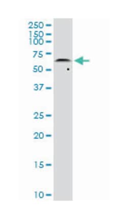 v-akt murine thymoma viral oncogene homolog 2, Mouse, Clone: 1B4, Abnova&trade;