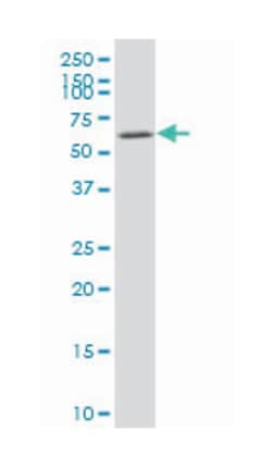 v-akt murine thymoma viral oncogene homolog 2, Mouse, Clone: 1B4, Abnova&trade;