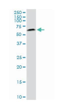 v-akt murine thymoma viral oncogene homolog 2, Mouse, Clone: 1B4, Abnova&trade;