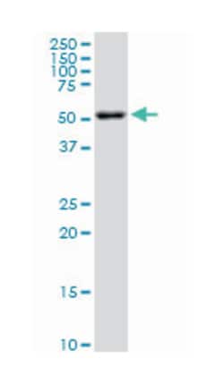 AKT2, Mouse, Clone: 1F8, Abnova 200&mu;L; Unlabeled:Antibodies, Monoclonal