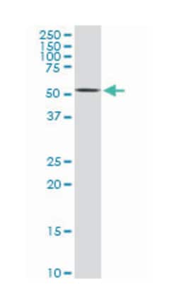 AKT2, Mouse, Clone: 1F8, Abnova 200&mu;L; Unlabeled:Antibodies, Monoclonal