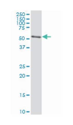 AKT2, Mouse, Clone: 1F8, Abnova 200&mu;L; Unlabeled:Antibodies, Monoclonal