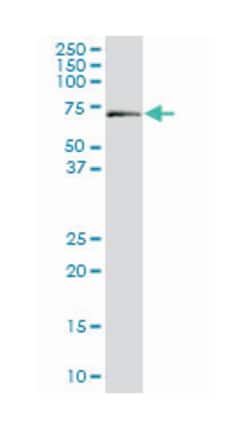 ALAS1, Mouse, Clone: 2D5, Abnova&trade;