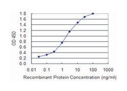 ALAS1, Mouse, Clone: 2D5, Abnova&trade;