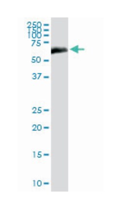 albumin, Rabbit, Polyclonal Antibody, Abnova 100&mu;g; Unlabeled:Antibodies