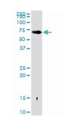 albumin, Rabbit, Polyclonal Antibody, Abnova 100&mu;g; Unlabeled:Antibodies