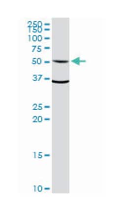 aldehyde dehydrogenase 1 family, member A1, Rabbit, Purified MaxPab Polyclonal