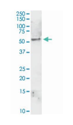 aldehyde dehydrogenase 1 family, member A1, Rabbit, Purified MaxPab Polyclonal