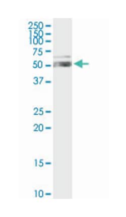aldehyde dehydrogenase 1 family, member A1, Rabbit, Purified MaxPab Polyclonal