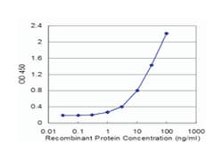 ALDH2, Mouse, Clone: 4F10, Abnova 100&mu;g; Unlabeled:Anticuerpos