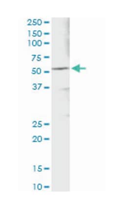 aldehyde dehydrogenase 3 family, memberA1, Mouse, Clone: 2G4, Abnova™