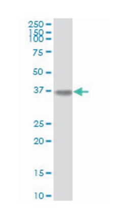 aldolase A, fructose-bisphosphate, Mouse, Clone: 3D9-6F3, Abnova&trade;