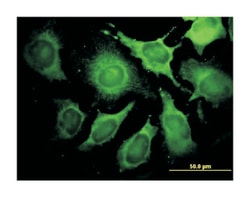 aldolase A, fructose-bisphosphate, Mouse, Clone: 3D9-6F3, Abnova&trade;