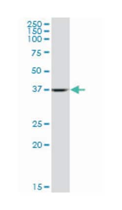 ALDOA, Mouse, Clone: 2E6, Abnova 100 &mu;g | Buy Online | Abnova | Fisher Scientific