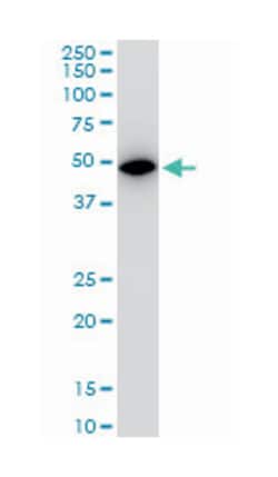 ALDOA, Mouse, Clone: 2E6, Abnova 100 &mu;g | Buy Online | Abnova | Fisher Scientific