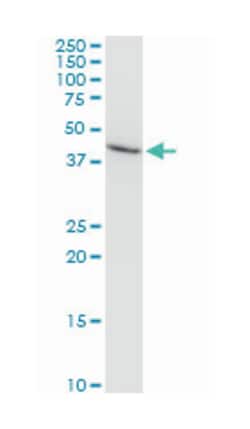 AMBP, Mouse, Clone: 1E4, Abnova 100&mu;g; Unlabeled:Antibodies, Monoclonal