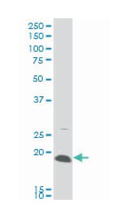 amelogenin (amelogenesis imperfecta 1, X-linked), Mouse, Clone: 3B5, Abnova™