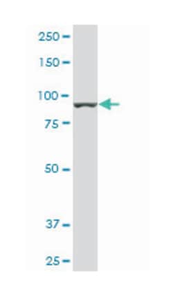 adenosine monophosphate deaminase 2 (isoform L), Mouse, Clone: 2F5, Abnova 50 &mu;g | Buy Online | Abnova Corporation | Fisher Scientific