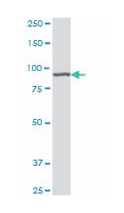 adenosine monophosphate deaminase 2 (isoform L), Mouse, Clone: 2F5, Abnova 50 &mu;g | Buy Online | Abnova Corporation | Fisher Scientific