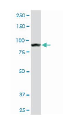 adenosine monophosphate deaminase 2 (isoform L), Mouse, Clone: 2F5, Abnova 50 &mu;g | Buy Online | Abnova Corporation | Fisher Scientific