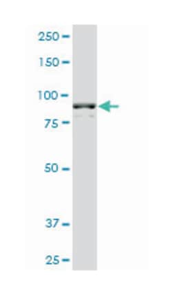 adenosine monophosphate deaminase 2 (isoform L), Mouse, Clone: 2F5, Abnova 50 &mu;g | Buy Online | Abnova Corporation | Fisher Scientific