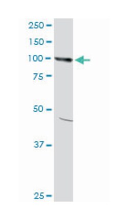 AMPD2 (M09A), Mouse anti-Human, Clone: 6A8, Abnova 200&mu;L; Unlabeled:Antibodies,