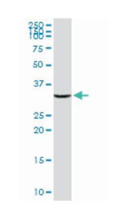 annexin A2, Rabbit, Purified MaxPab Polyclonal Antibody, Abnova 100 &mu;g | Buy Online | Abnova | Fisher Scientific