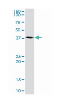 annexin A2, Rabbit, Purified MaxPab Polyclonal Antibody, Abnova 100 &mu;g | Buy Online | Abnova | Fisher Scientific