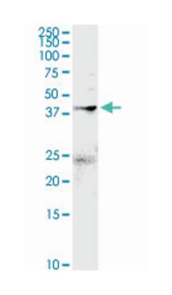 annexin A2, Rabbit, Purified MaxPab Polyclonal Antibody, Abnova 100 &mu;g | Buy Online | Abnova | Fisher Scientific