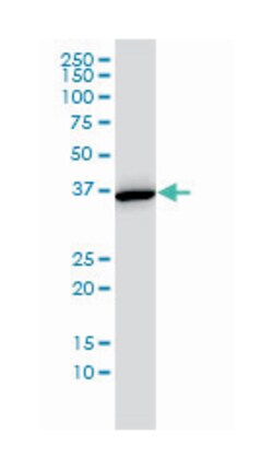 annexin A2, Mouse, Clone: 1G7, Abnova 100&mu;g; Unlabeled:Antibodies, Monoclonal