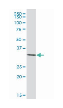 annexin A3, Mouse, Purified MaxPab Polyclonal Antibody, Abnova 50&mu;g;