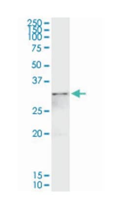 annexin A4, Rabbit, Purified MaxPab Polyclonal Antibody, Abnova 100&mu;g;