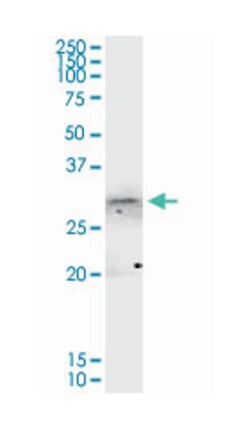 annexin A4, Rabbit, Purified MaxPab Polyclonal Antibody, Abnova 100&mu;g;