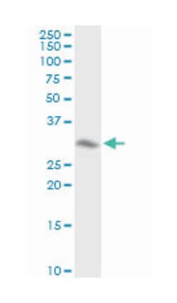 annexin A4, Rabbit, Purified MaxPab Polyclonal Antibody, Abnova 100&mu;g;
