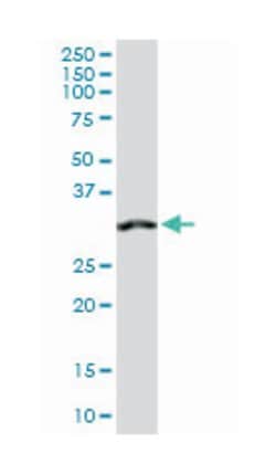 annexin A4, Rabbit, Purified MaxPab Polyclonal Antibody, Abnova 100&mu;g;