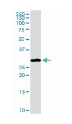 annexin A4, Rabbit, Purified MaxPab Polyclonal Antibody, Abnova 100&mu;g;