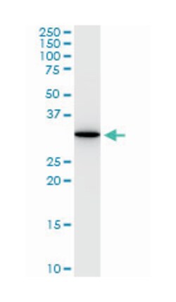 ANXA5, Mouse, Clone: 1F4-1A5, Abnova 100&mu;g; Unlabeled:Antibodies, Monoclonal