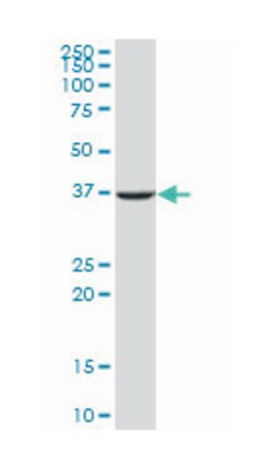 APEX nuclease (multifunctional DNA repair enzyme) 1 (B01), Mouse anti-Human,