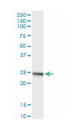 APOA1, Mouse, Clone: 3A11-1A9, Abnova 200&mu;L; Unlabeled:Antibodies, Monoclonal