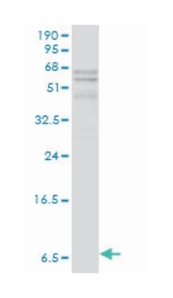 APOC1, Mouse, Clone: 2E2-1A3, Abnova 100&mu;g; Unlabeled:Antibodies, Monoclonal