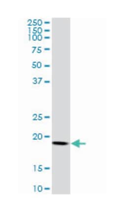 ADP-ribosylation factor 5, Mouse, Clone: 1B4, Abnova 100&mu;g; Unlabeled:Antibodies,