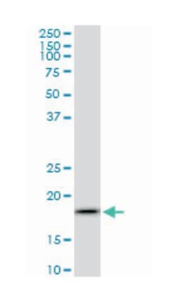 ADP-ribosylation factor 5, Mouse, Clone: 1B4, Abnova 100&mu;g; Unlabeled:Antibodies,