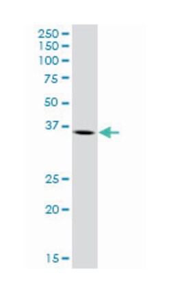 arginase, type II, Mouse, Purified MaxPab Polyclonal Antibody, Abnova 50&mu;g;