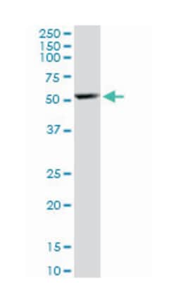 Rho GTPase activating protein 1, Mouse, Polyclonal Antibody, Abnova 50 &mu;L | Buy Online | Abnova | Fisher Scientific