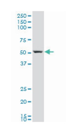 Rho GTPase activating protein 1, Mouse, Polyclonal Antibody, Abnova 50 &mu;L | Buy Online | Abnova | Fisher Scientific
