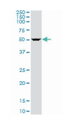 Rho GTPase activating protein 1, Mouse, Polyclonal Antibody, Abnova 50 &mu;L | Buy Online | Abnova | Fisher Scientific